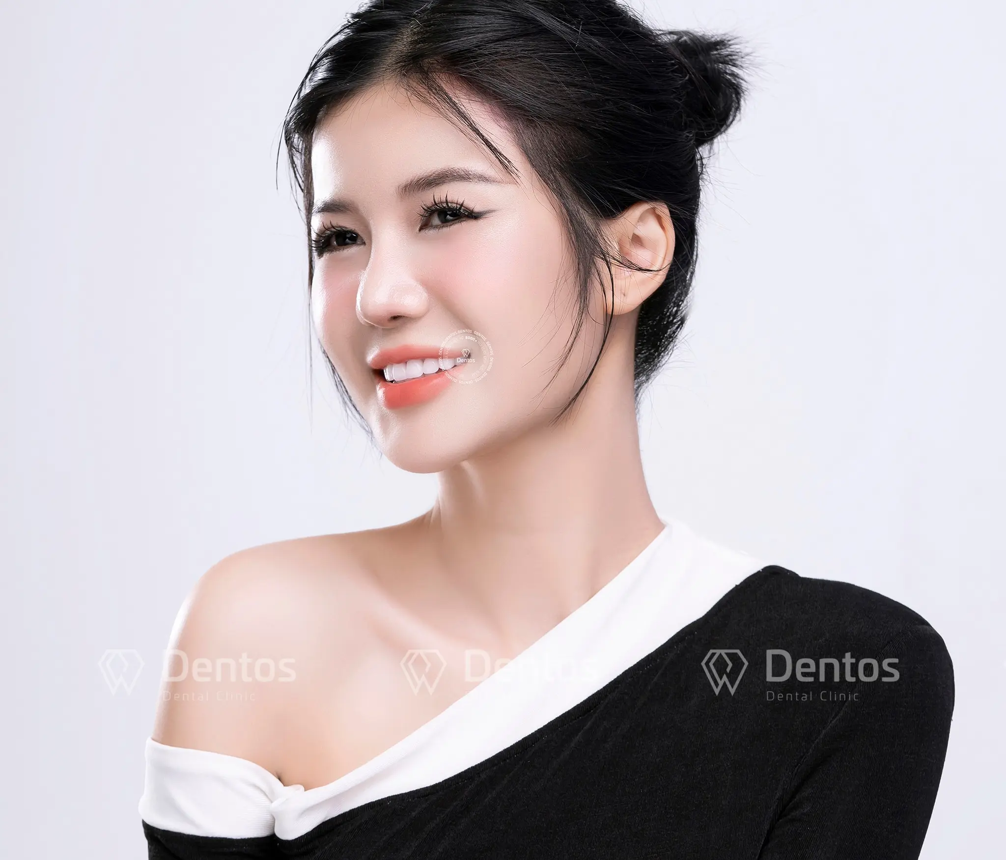 Bọc răng sứ loại nào tốt? 5 tiêu chí vàng để bạn lựa chọn